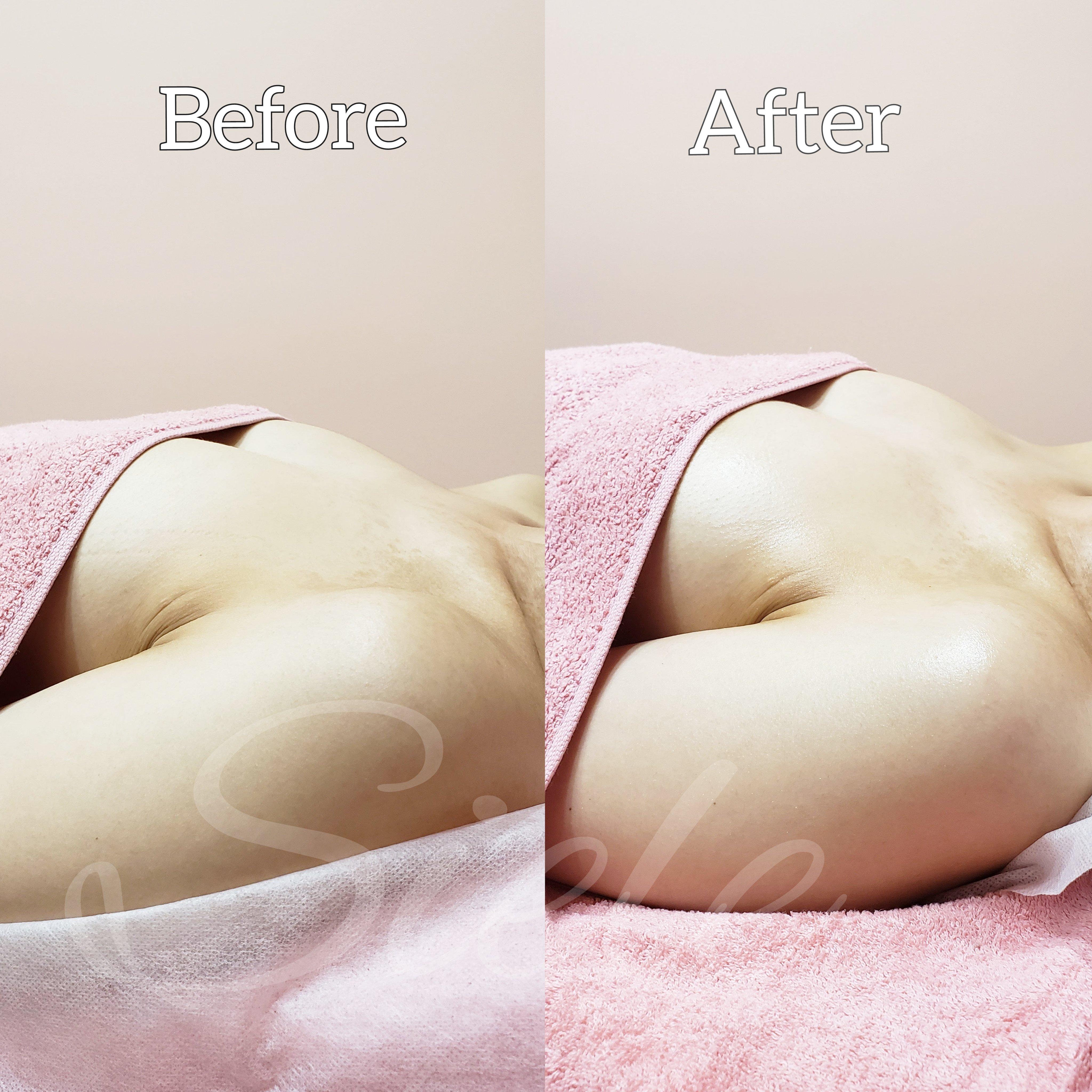 バストアップ ビフォーアフター