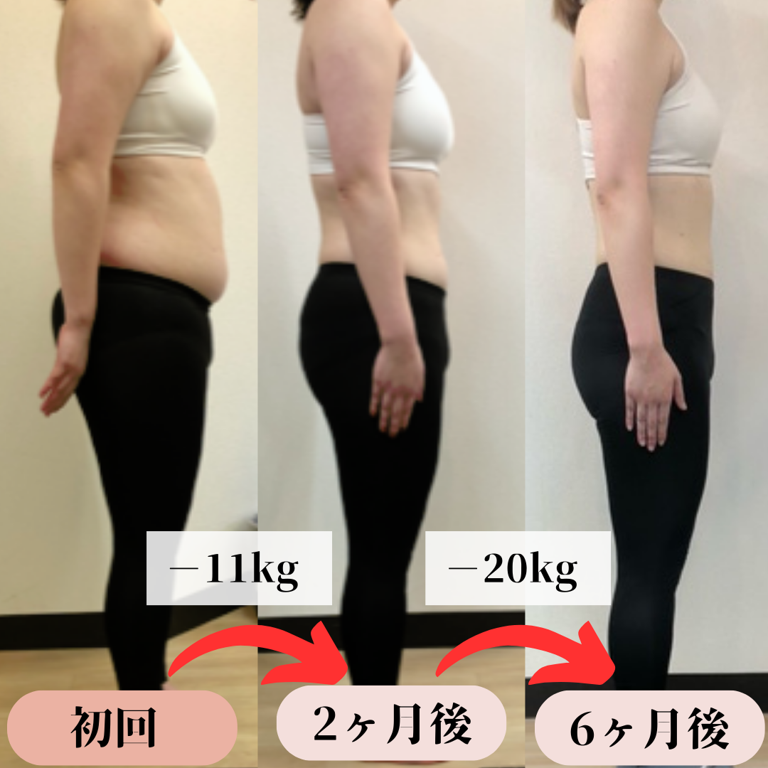 お客様のビフォーアフター画像1