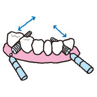 歯間ブラシの使い方