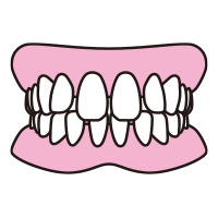 歯と歯の間にすき間