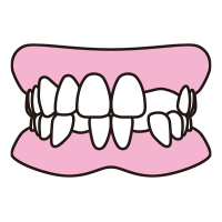 抜けた歯がある