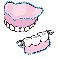忘れやすいポイント