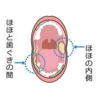 お口の中の汚れやすい場所