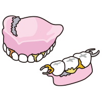 入れ歯の汚れるポイント