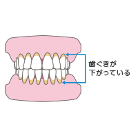 歯ぐきが下がっている