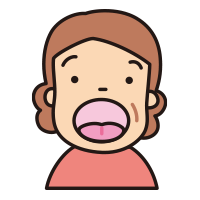 お口の中の観察