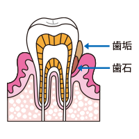 歯みがきポイント