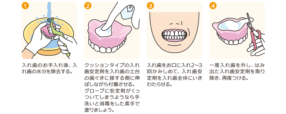 クッションタイプの入れ歯安定剤