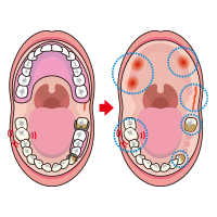 観察のポイント