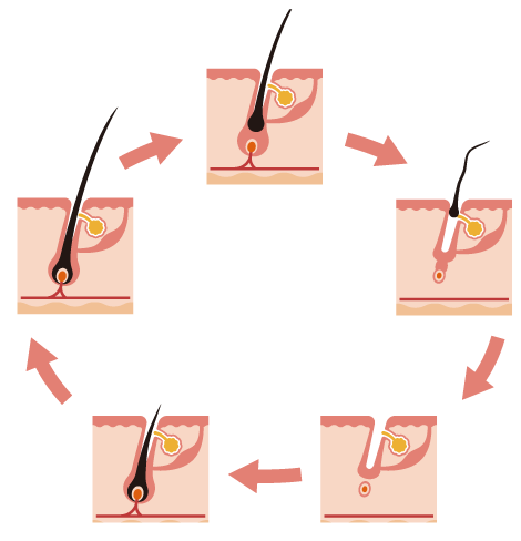 毛髪のリサイクル、藤沢ソーマクリニックで治療