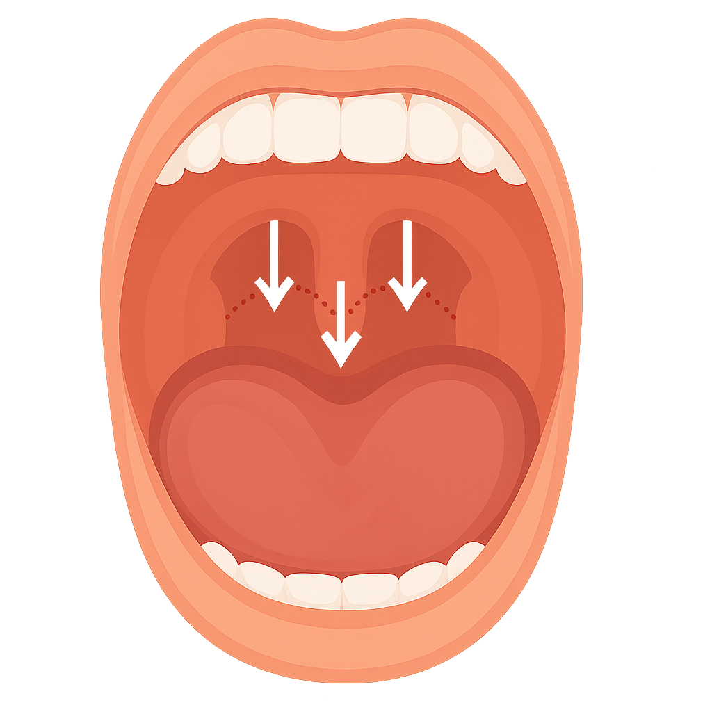 いびきレーザーの作用①