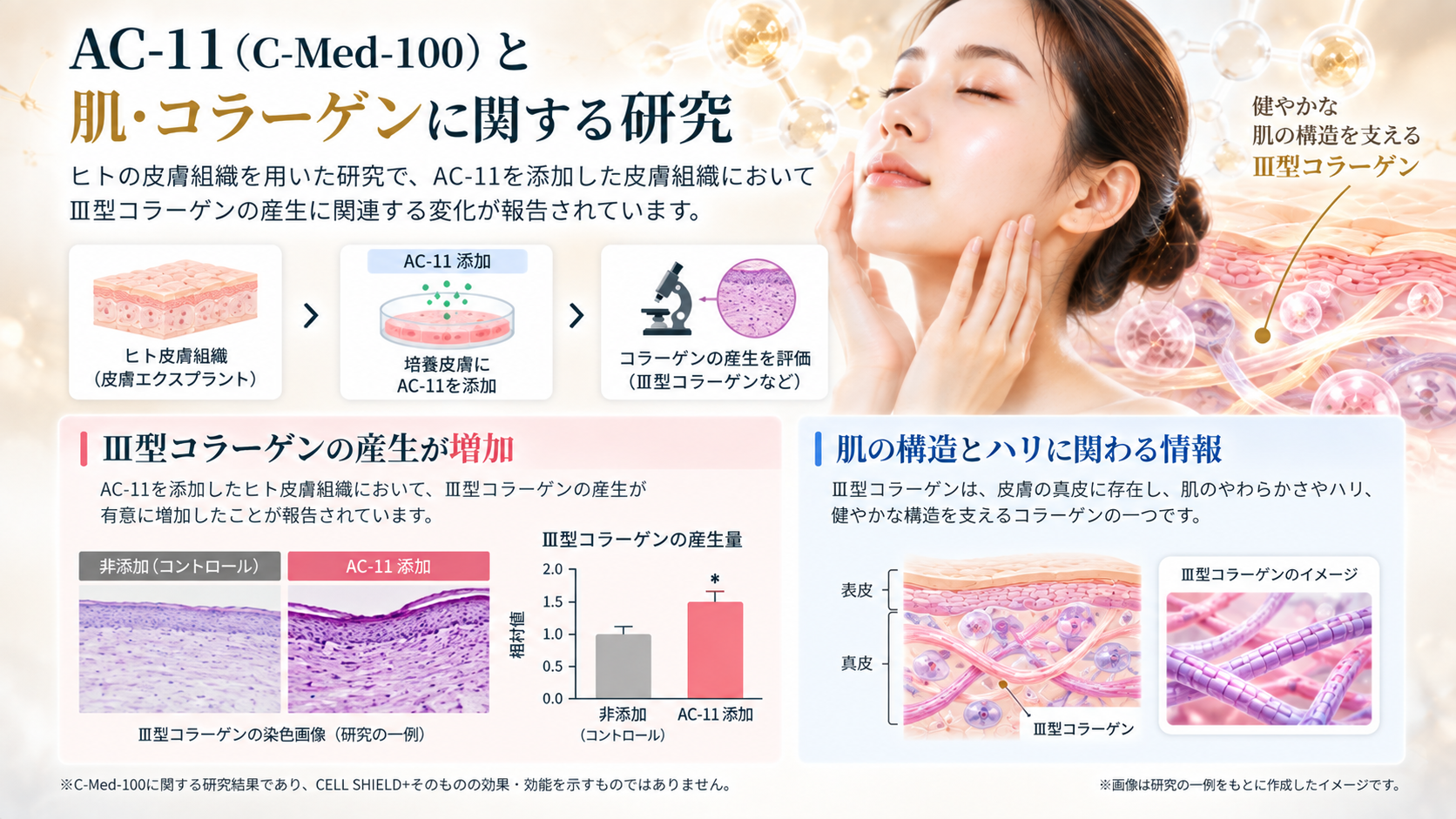 AC11の期待値4