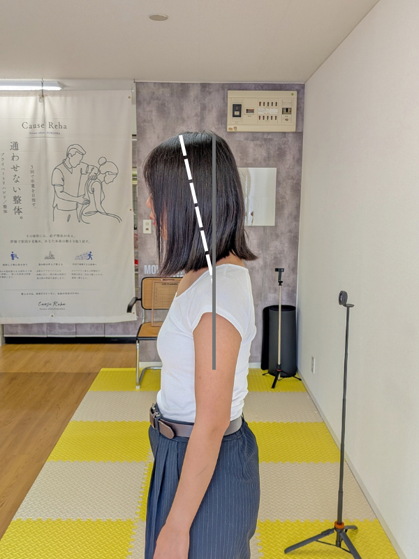 取り組み前の立位姿勢（側面）｜首・肩の慢性的な不調・30代女性｜Cause Reha FUKUOKA
