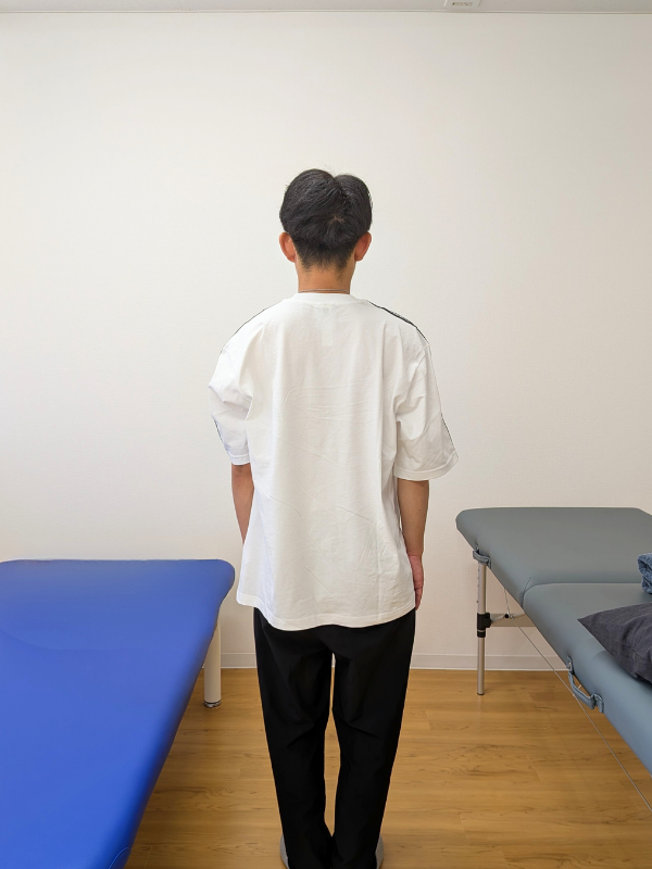 施術後の立位姿勢（背面）｜肩こり・姿勢の不調・30代男性｜Cause Reha FUKUOKA