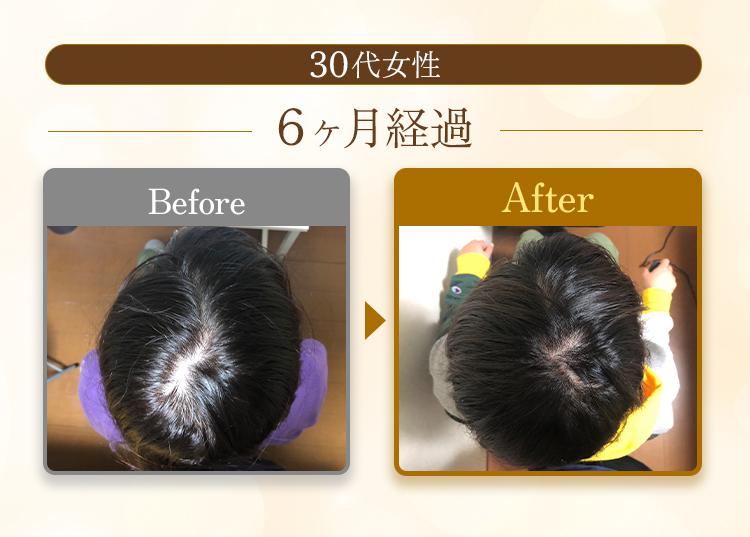 ビフォーアフター30代女性