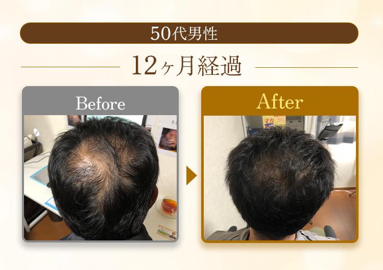 ビフフォーアフター50代男性