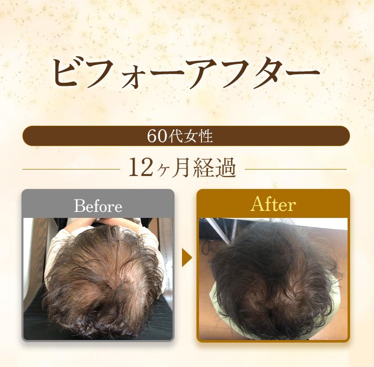 ビフォーアフター　60代女性