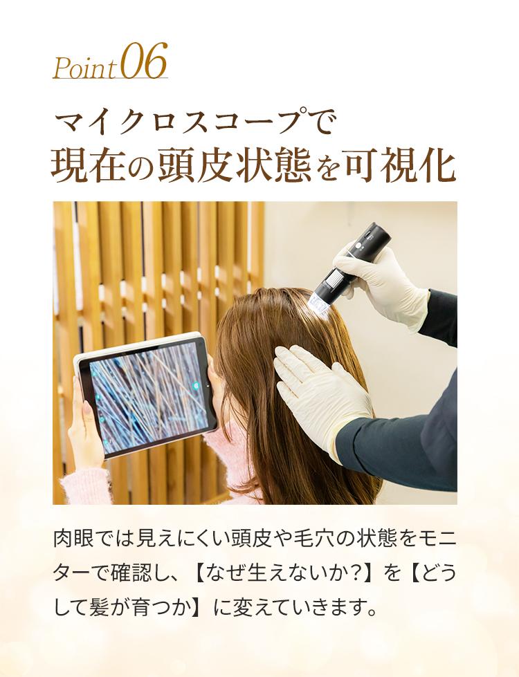 06＿マイクロスコープで現在の頭皮状態を可視化
