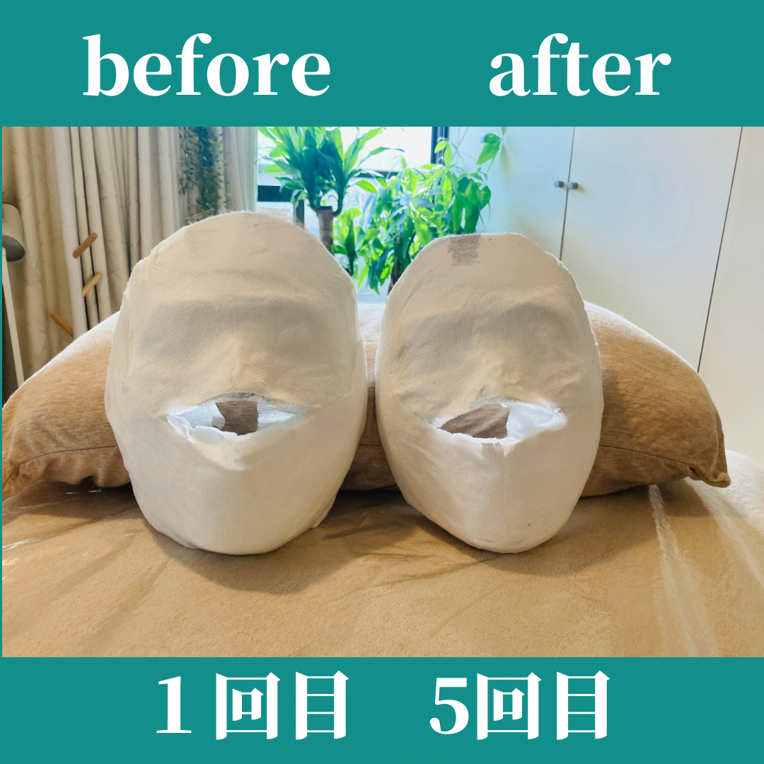 小顔/コルギ/石膏パック/ビフォーアフター/吉祥寺