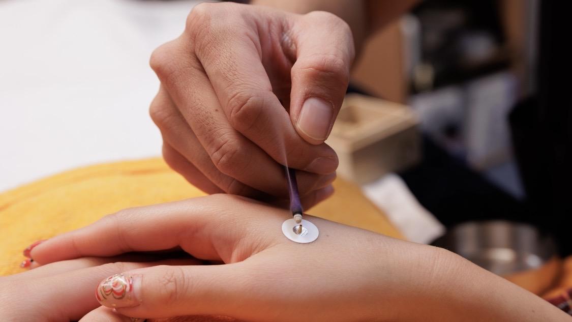 胃腸の不調には灸が有効です