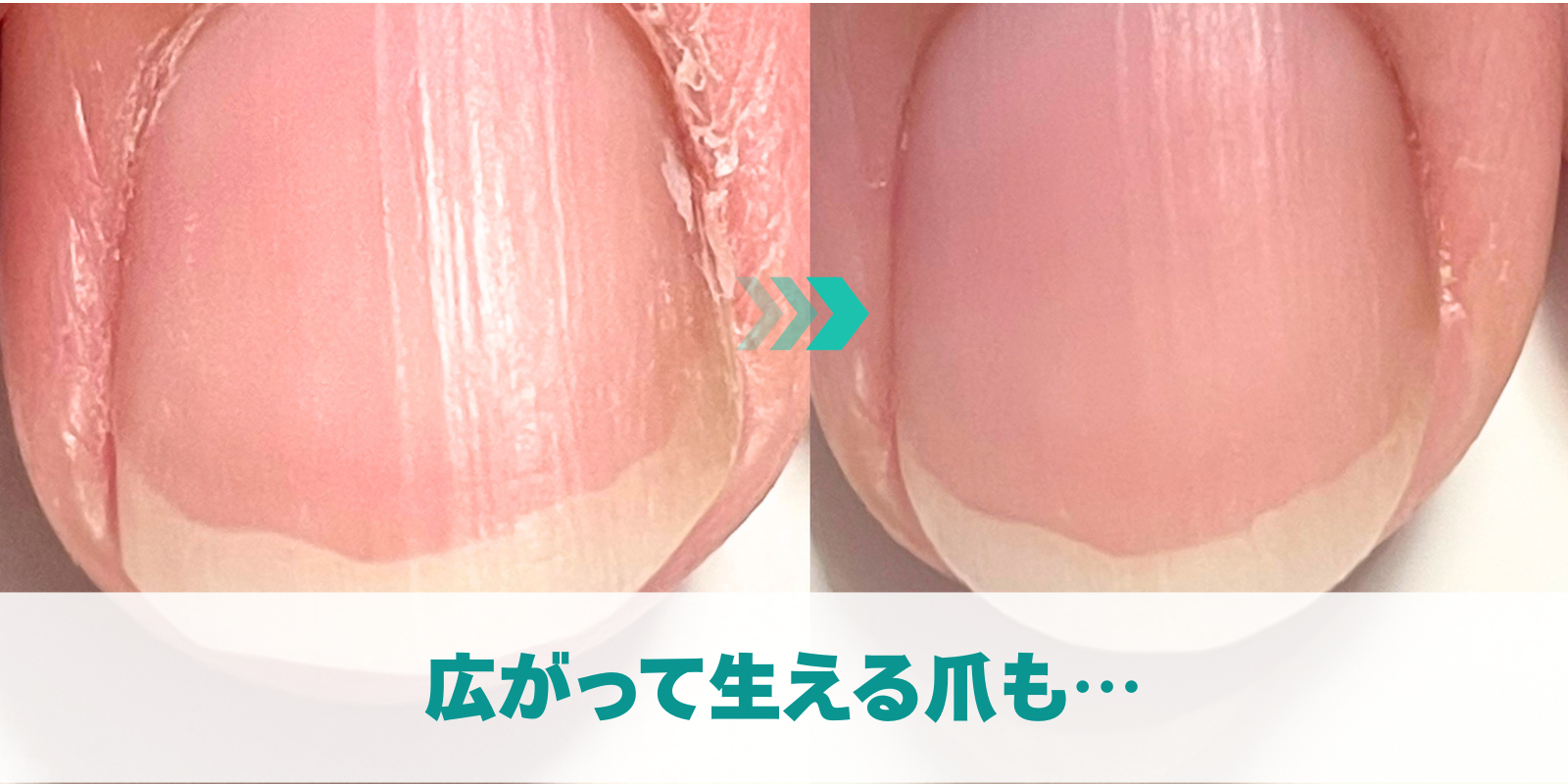 広がって生える爪も…