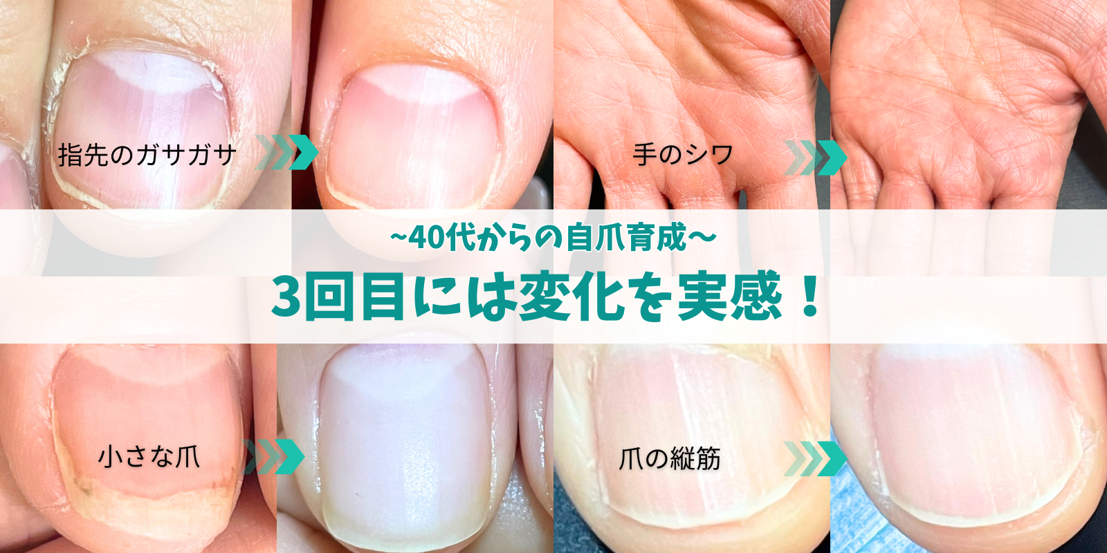 【40代からの自爪育成】3回目には変化を実感