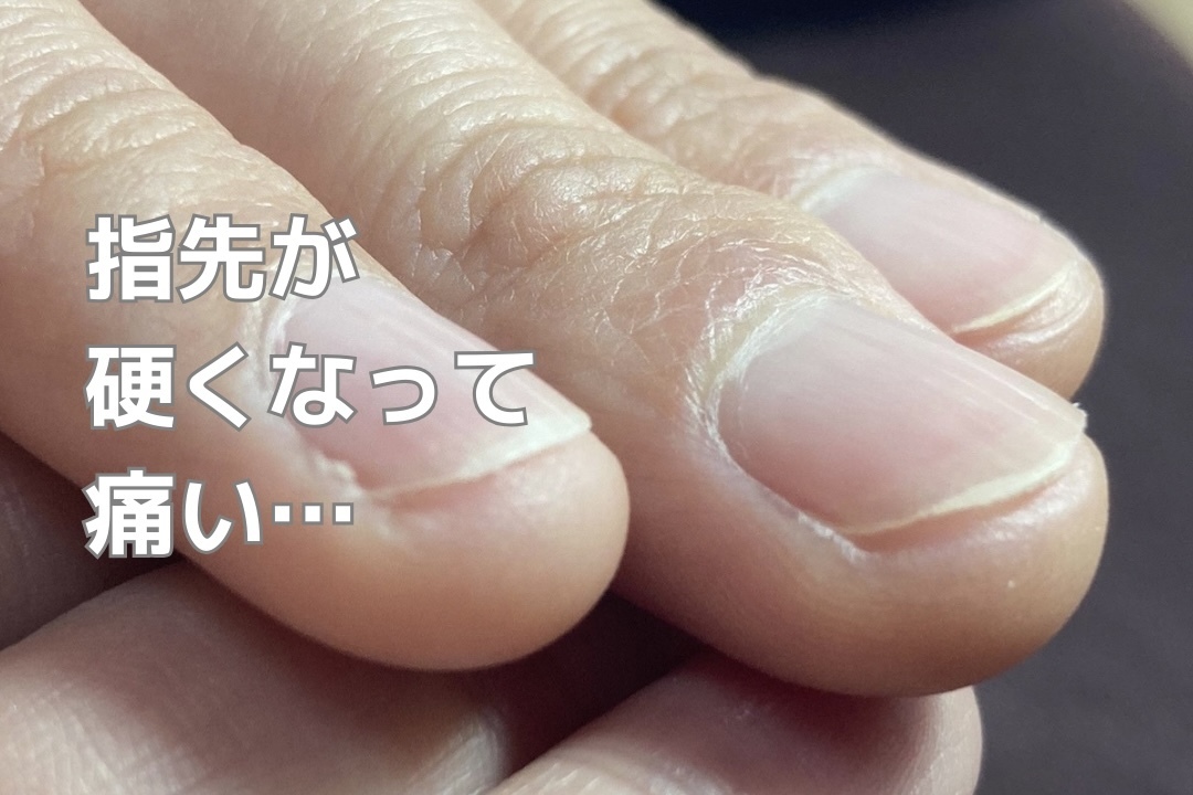 インスタグラム