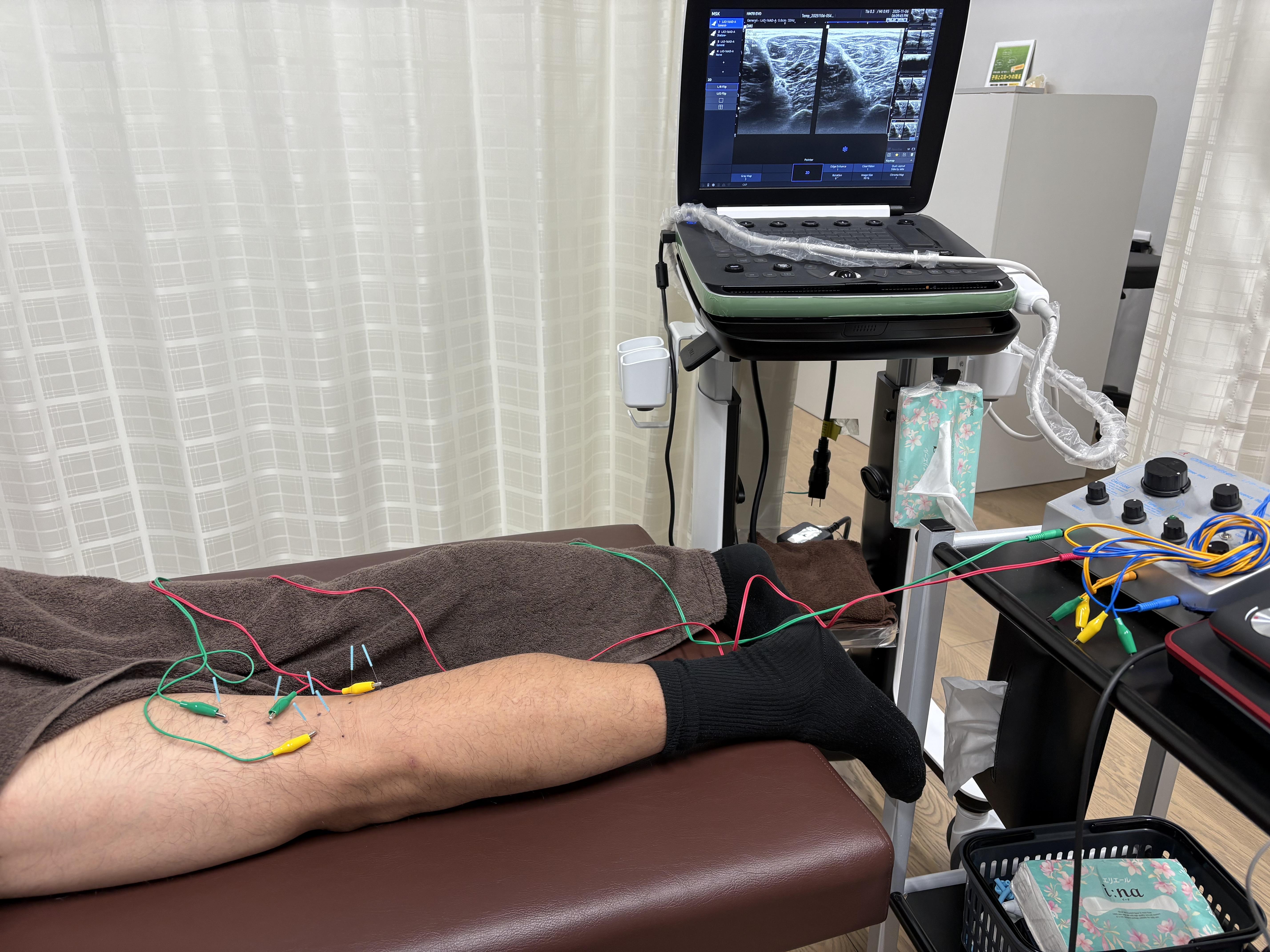 バスケットボールクラブチームへ怪我予防講座