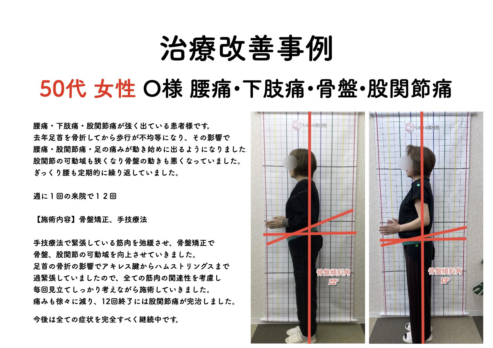 春日市ⅠLuna整骨院・レディース整体院の改善ビフォーアフター
