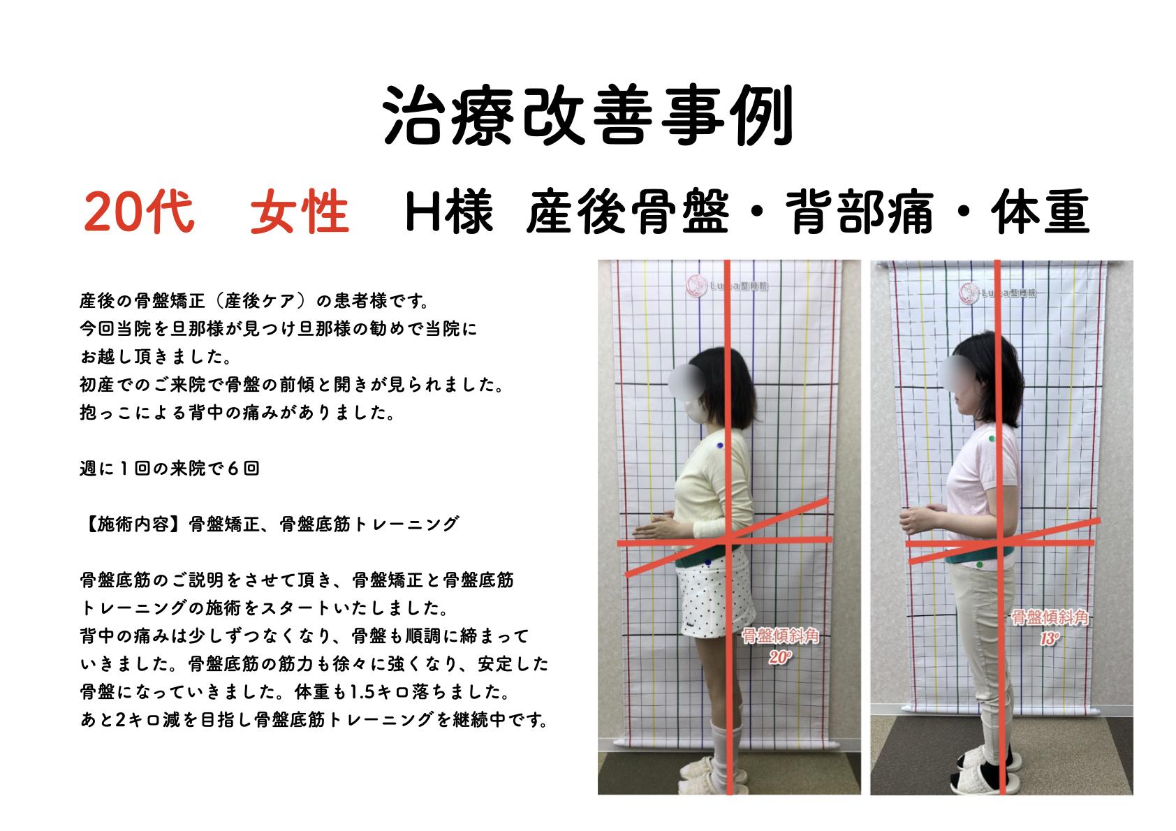 春日市ⅠLuna整骨院・レディース整体院の改善ビフォーアフター