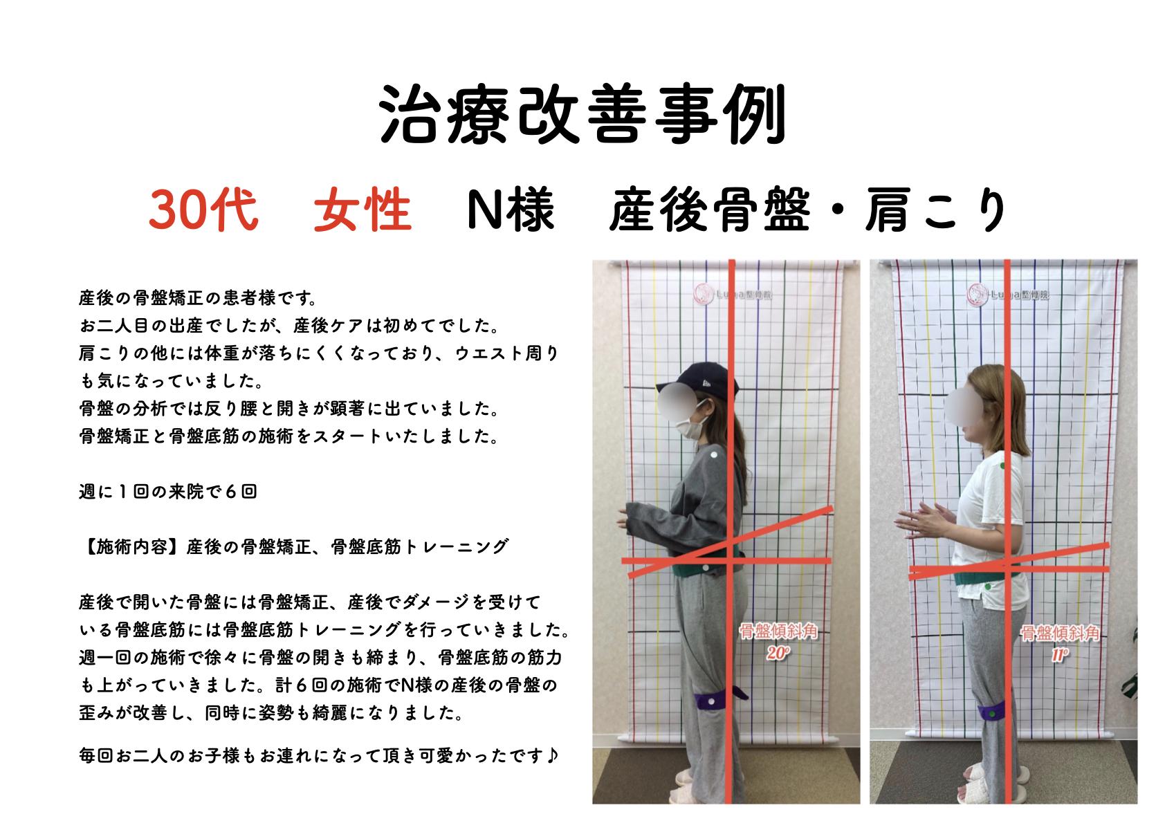 春日市ⅠLuna整骨院・レディース整体院の改善ビフォーアフター