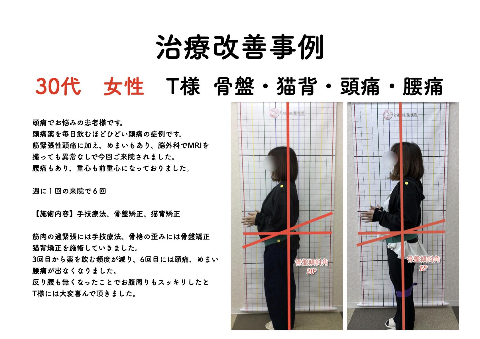 春日市ⅠLuna整骨院・レディース整体院の改善ビフォーアフター