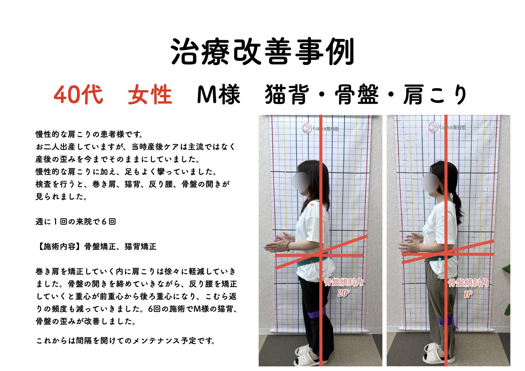 春日市ⅠLuna整骨院・レディース整体院の改善ビフォーアフター