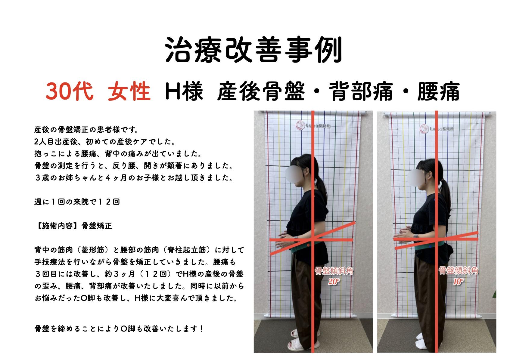 春日市ⅠLuna整骨院・レディース整体院の改善ビフォーアフター