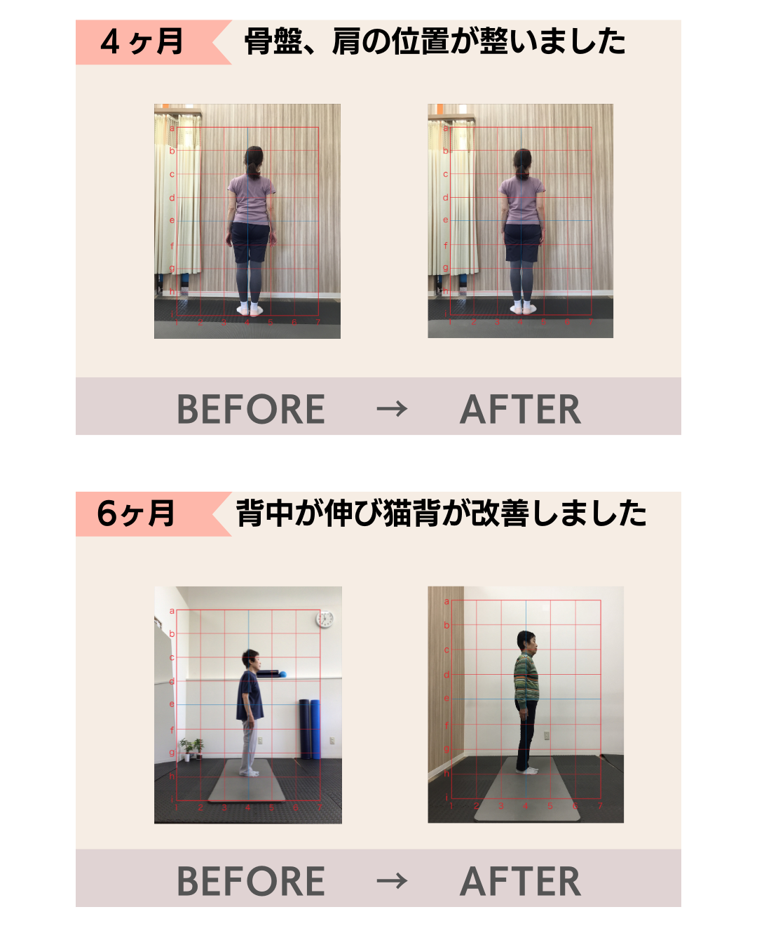 富雄みなみ整骨院　患者さんの喜びの声　猫背が改善した写真