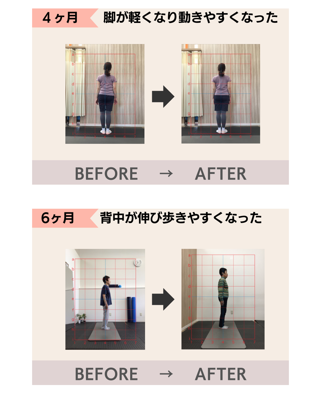 富雄みなみ整骨院　脊柱管狭窄症　腰痛　肩こり　骨盤矯正　奈良市　藤ノ木台　六条緑町　青垣台　丸山　千代ヶ丘　西千代ヶ丘