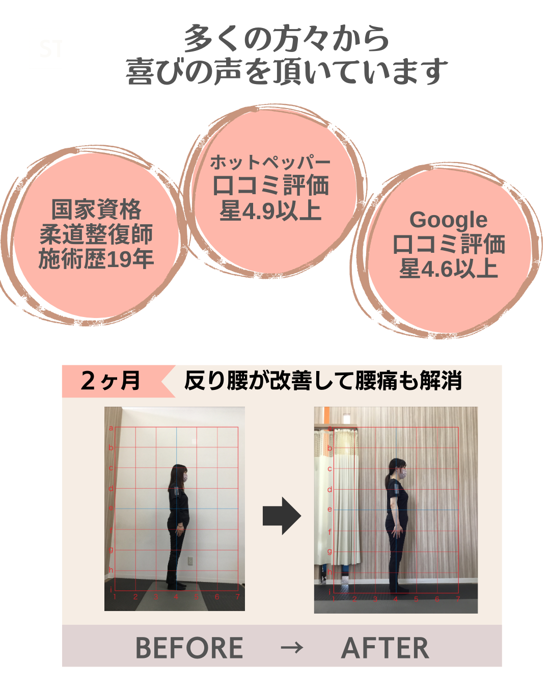 富雄みなみ整骨院　脊柱管狭窄症　腰痛　肩こり　骨盤矯正　奈良市　藤ノ木台　六条緑町　青垣台　丸山　千代ヶ丘　西千代ヶ丘