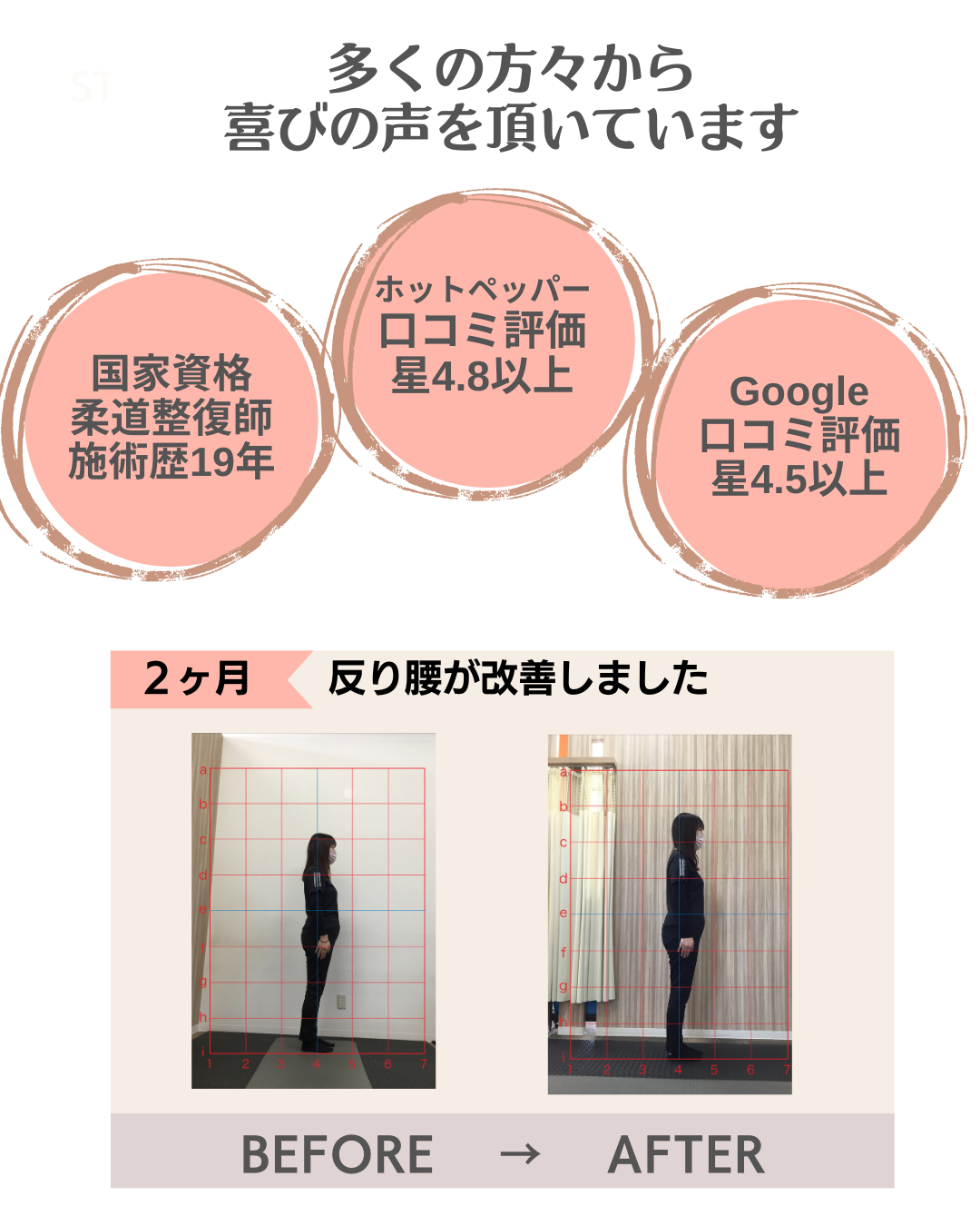 富雄みなみ整骨院　反り腰が改善した写真　患者さんの喜びの声