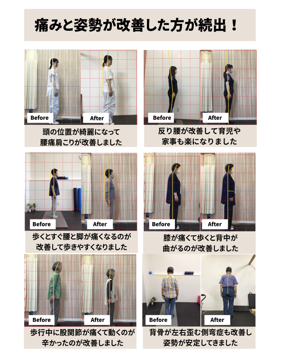 富雄みなみ整骨院　脊柱管狭窄症　腰痛　肩こり　骨盤矯正　奈良市　富雄　学園前　生駒　西ノ京　藤ノ木台　六条緑町　青垣台　丸山　千代ヶ丘　西千代ヶ丘