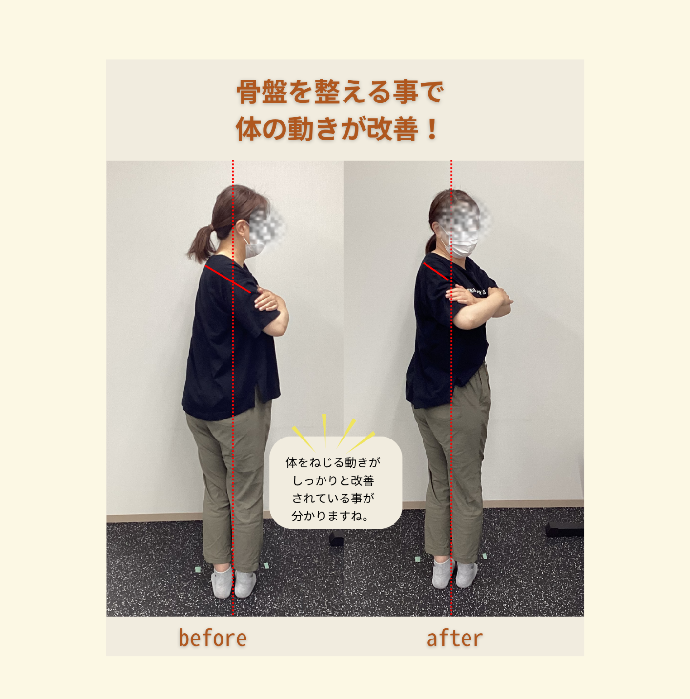 実際のお客様の変化写真②
