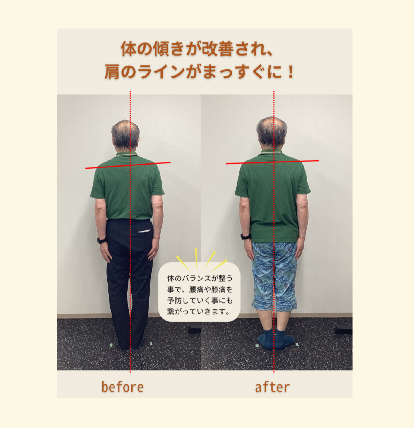 実際のお客様の変化写真③