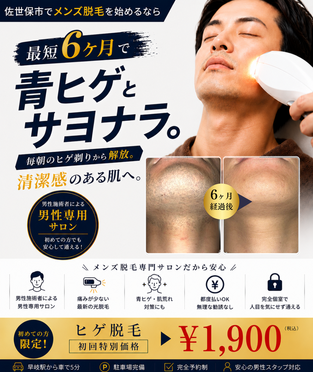 メンズ脱毛サロンMomona_ヒゲ脱毛