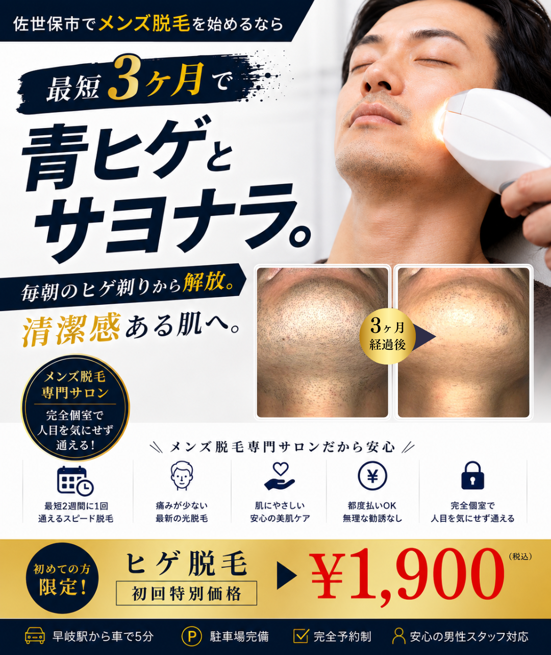 メンズ脱毛サロンMomona_髭用