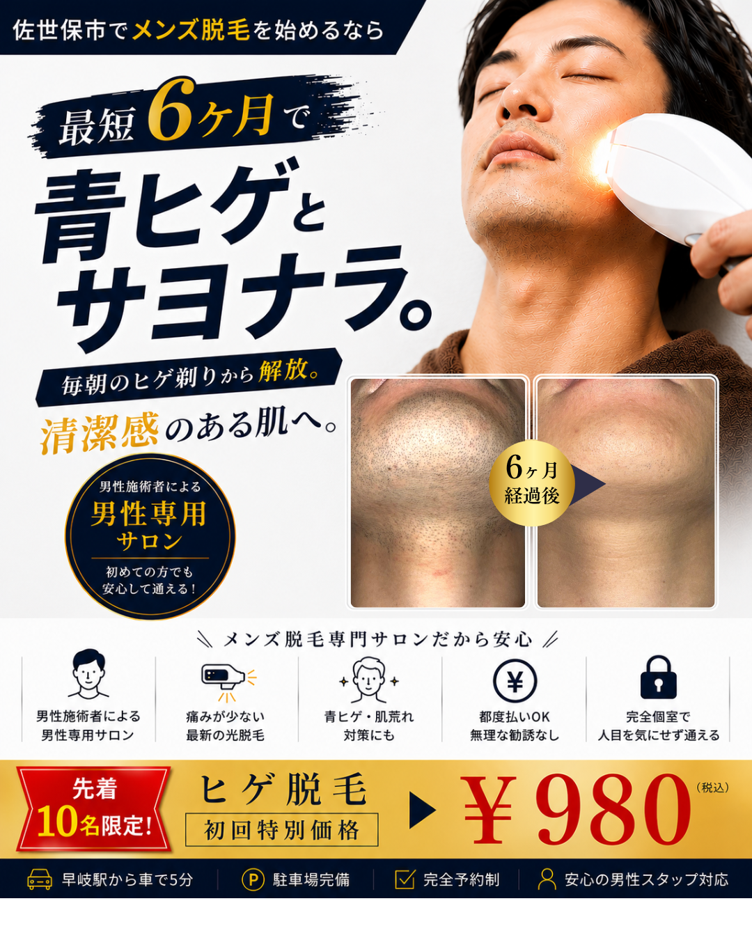 メンズ脱毛サロンMomona_ヒゲ脱毛