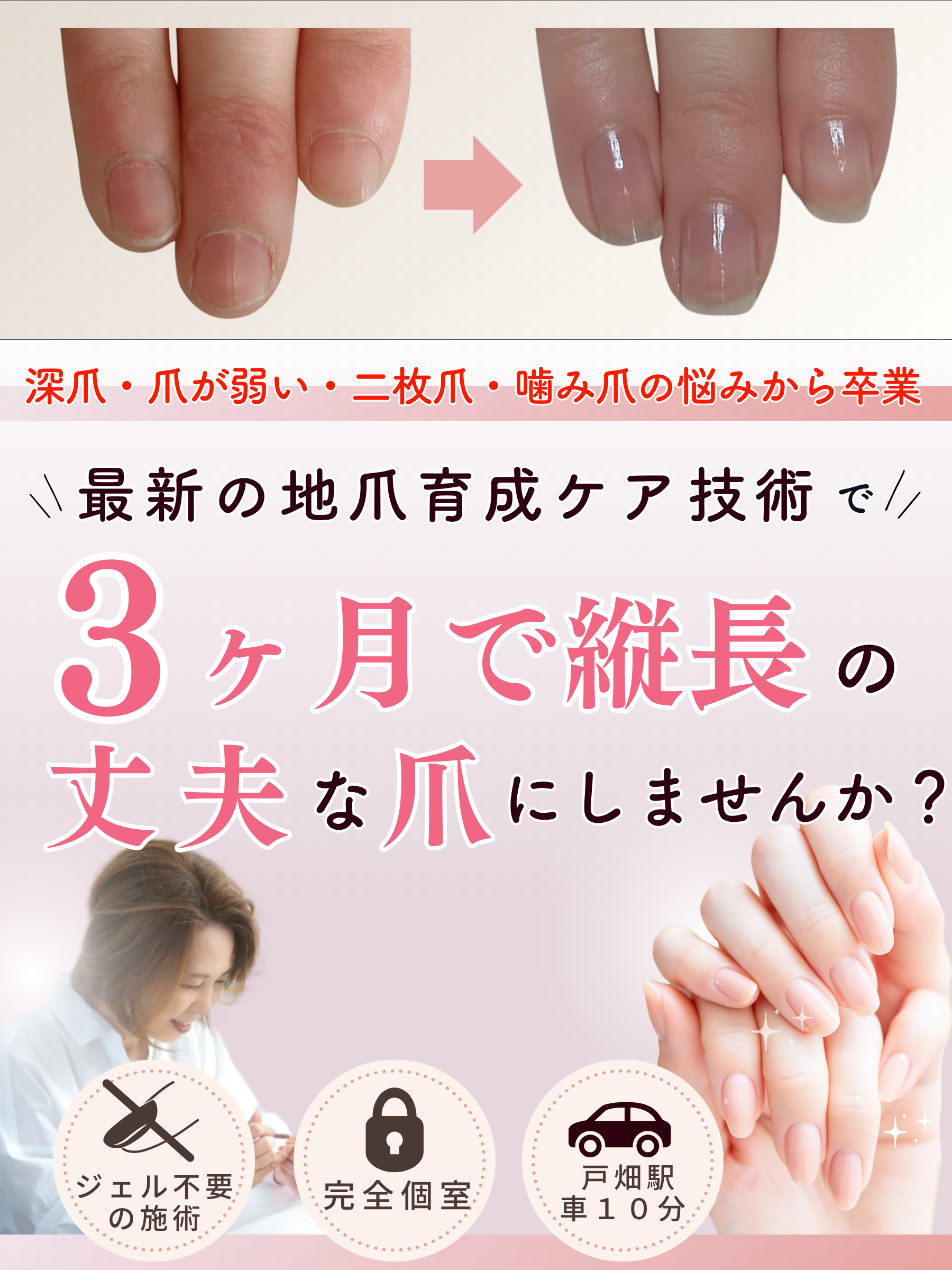 北九州 戸畑｜自爪育成・ネイルケア専門サロン【グロッシィネイル】