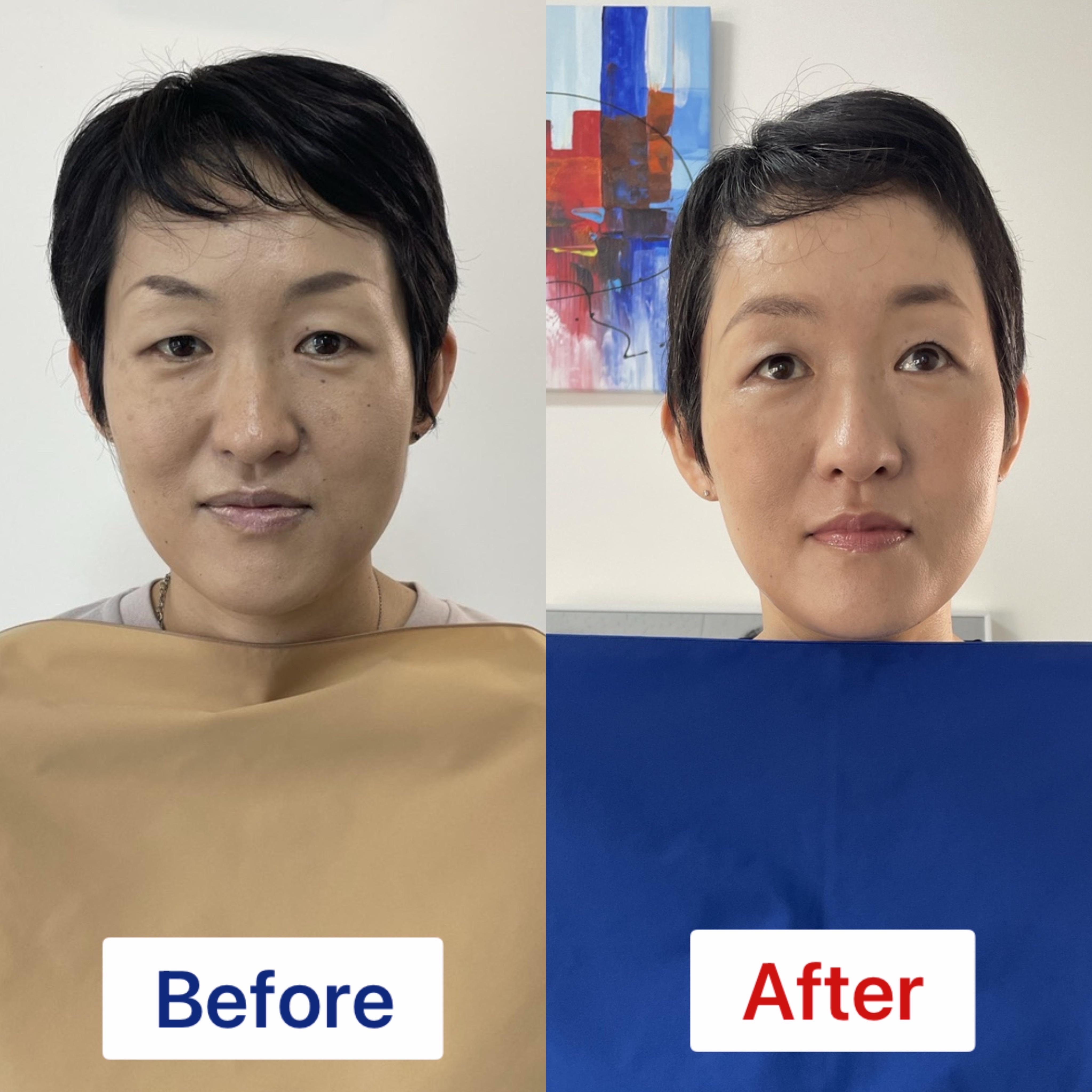 50代女性のメイクビフォーアフターの写真