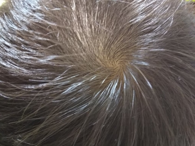 代若白髪女子がおすすめ カラートリートメントランキング