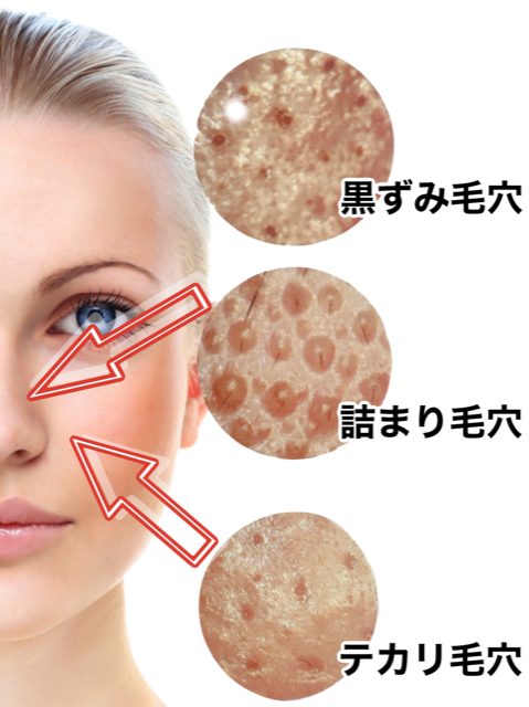 佐賀毛穴ケア専門エステ サンルイス 佐賀毛穴ケア専門エステ サンルイス