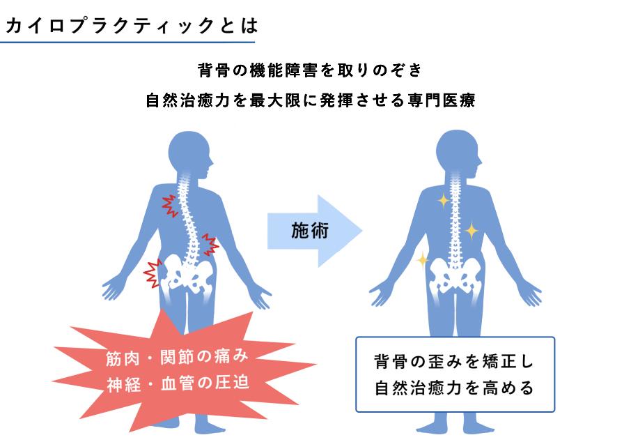 手術なしで症状を改善できる「カイロプラクティック」とは