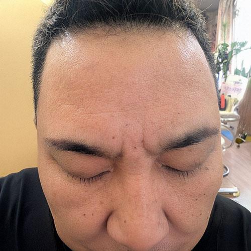 メンズ眉カット施術後の写真